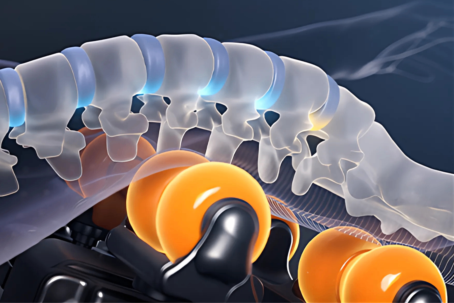 Spine Tech™